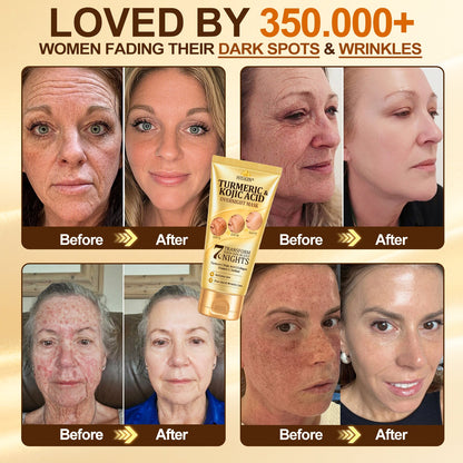 𝑶𝒇𝒇𝒊𝒄𝒊𝒂𝒍 𝑺𝒕𝒐𝒓𝒆 | 𝐍𝐞𝐰! ✨ 𝐇𝐢𝐬𝐤𝐢𝐧® 𝐓𝐮𝐫𝐦𝐞𝐫𝐢𝐜 × 𝐊𝐨𝐣𝐢𝐜 𝐀𝐜𝐢𝐝 𝐎𝐯𝐞𝐫𝐧𝐢𝐠𝐡𝐭 𝐏𝐞𝐞𝐥-𝐎𝐟𝐟 𝐌𝐚𝐬𝐤 — 𝐅𝐚𝐝𝐞 𝐒𝐭𝐮𝐛𝐛𝐨𝐫𝐧 𝐃𝐚𝐫𝐤 𝐒𝐩𝐨𝐭𝐬 & 𝐒𝐦𝐨𝐨𝐭𝐡 𝐕𝐢𝐬𝐢𝐛𝐥𝐞 𝐖𝐫𝐢𝐧𝐤𝐥𝐞𝐬 𝐖𝐡𝐢𝐥𝐞 𝐘𝐨𝐮 𝐒𝐥𝐞𝐞𝐩 🌙✨ 𝐓𝐮𝐫𝐦𝐞𝐫𝐢𝐜 × 𝐊𝐨𝐣𝐢𝐜 𝐀𝐜𝐢𝐝 × 𝐏𝐞𝐩𝐭𝐢𝐝𝐞𝐬 ✅ 𝐎𝐧𝐞 𝐒𝐭𝐞𝐩 𝐚 𝐍𝐢𝐠𝐡𝐭 · 𝐕𝐢𝐬𝐢𝐛𝐥𝐞 𝐂𝐡𝐚𝐧𝐠𝐞𝐬 𝐢𝐧 𝟕 𝐍𝐢𝐠𝐡𝐭𝐬 💯