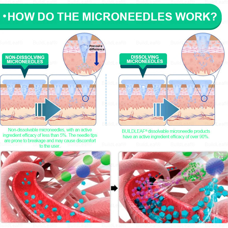 💥Congratulations! You have unlocked an exclusive BuildLeaf® offer! 🎁 As a thank you for your order, we're offering an additional 30% off today! Click below to grab this special offer, offer expires! ✨