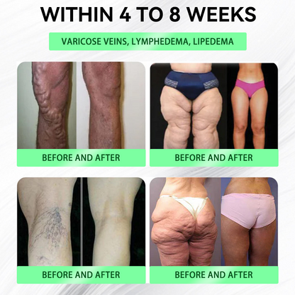 💥Congratulations! You have unlocked an exclusive BuildLeaf® offer! 🎁 As a thank you for your order, we're offering an additional 30% off today! Click below to grab this special offer, offer expires! ✨